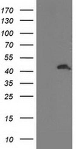 ATG3 Monoclonal Antibody (OTI2B9), TrueMAB , OriGene:Antibodies:Primary