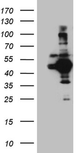 ATG4B Mouse anti-Human, Clone: OTI1A3, lyophilized, TrueMAB 100 &mu;g;