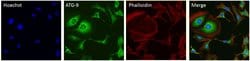 Invitrogen™ ATG9A Monoclonal Antibody (14F2 8B1), Alexa Fluor™ 488