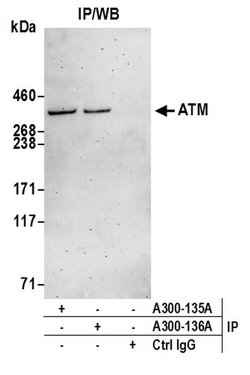 ATM Goat anti-Human, Mouse, Polyclonal, Bethyl Laboratories 100 &mu;L;