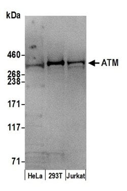 ATM Goat anti-Human, Mouse, Polyclonal, Bethyl Laboratories 100 &mu;L;
