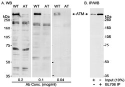 ATM Rabbit anti-Human, Polyclonal, Bethyl Laboratories 100 &mu;L; Unconjugated:Antibodies,