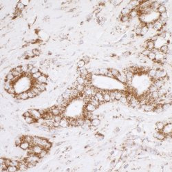 ATP5A1 Rabbit anti-Human, Mouse, Polyclonal, Bethyl Laboratories 100 &mu;L;