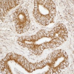 ATP5A1 Rabbit anti-Human, Mouse, Polyclonal, Bethyl Laboratories 100 &mu;L;