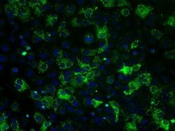 ATP5B Mouse anti-Canine, Human, Rat, Clone: OTI5G2, lyophilized, TrueMAB