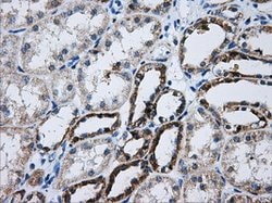 ATP5B Mouse anti-Human, Clone: OTI6B11, lyophilized, TrueMAB 100 &mu;g;