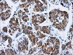ATP5B Mouse anti-Canine, Human, Rat, Clone: OTI5G2, lyophilized, TrueMAB