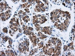 ATP5B Mouse anti-Canine, Human, Rat, Clone: OTI5G2, liquid, TrueMAB 100