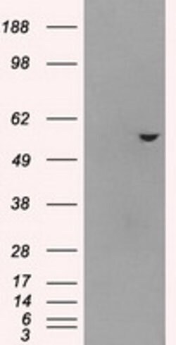 ATP5B Mouse anti-Canine, Human, Rat, Clone: OTI6C10, lyophilized, TrueMAB