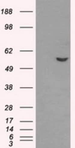 ATP5B Mouse anti-Human, Clone: OTI6B11, lyophilized, TrueMAB 100 &mu;g;