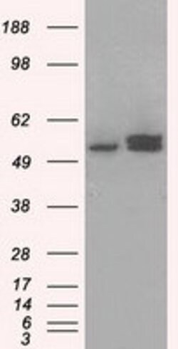 ATP5B Mouse anti-Canine, Human, Rat, Clone: OTI5G2, lyophilized, TrueMAB