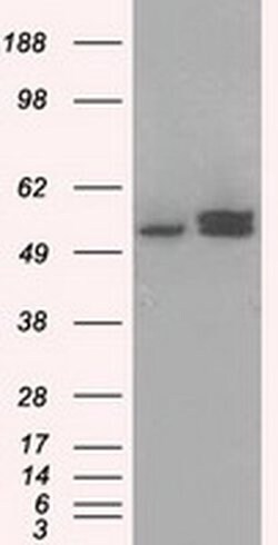 ATP5B Mouse anti-Canine, Human, Rat, Clone: OTI5G2, liquid, TrueMAB 100