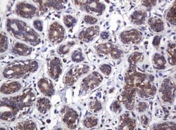 ATP5C1 Mouse anti-Human, Clone: OTI2H6, lyophilized, TrueMAB 100 &mu;g;