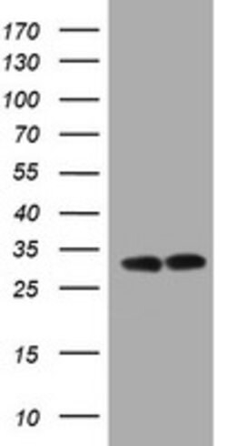 ATP5C1 Mouse anti-Human, Clone: OTI2H6, lyophilized, TrueMAB 100 &mu;g;