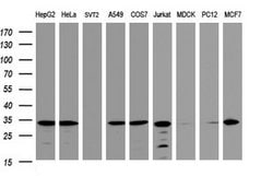 ATP5C1 Mouse anti-Human, Clone: OTI2H6, lyophilized, TrueMAB 100 &mu;g;