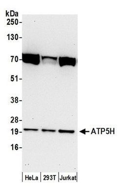 ATP5H Polyclonal Antibody, Bethyl Laboratories 20 &mu;L; Unconjugated:Antibodies,