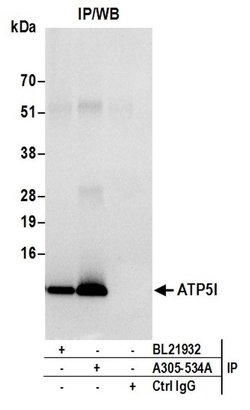 ATP5I Rabbit anti-Human, Mouse, Polyclonal, Bethyl Laboratories 100 &mu;L | Buy Online | Bethyl Laboratories, Inc | Fisher Scientific