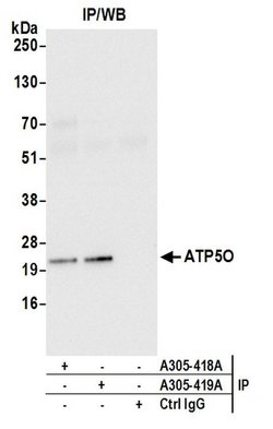 ATP5O Rabbit anti-Human, Polyclonal, Bethyl Laboratories 100 &mu;L; Unconjugated:Antibodies,