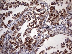 ATP5O Mouse anti-Human, Clone: OTI2E9, lyophilized, TrueMAB 100 &mu;g;