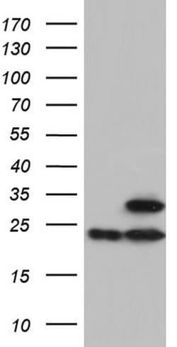 ATP5O Mouse anti-Human, Clone: OTI2E9, lyophilized, TrueMAB 100 &mu;g;