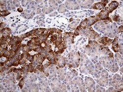 ATP6V0D2 Monoclonal Antibody (OTI2D6), TrueMAB , OriGene 100 &mu;L | Buy Online | Origene Technologies | Fisher Scientific