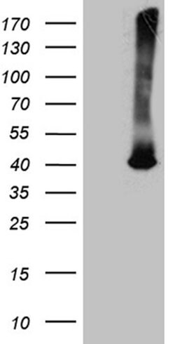 ATP6V0D2 Monoclonal Antibody (OTI2D6), TrueMAB , OriGene 100 &mu;L | Buy Online | Origene Technologies | Fisher Scientific