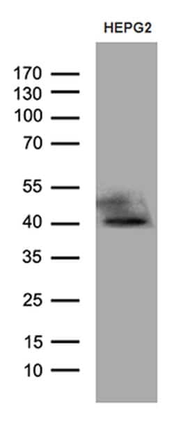 ATP6V0D2 Monoclonal Antibody (OTI2D6), TrueMAB , OriGene 100 &mu;L | Buy Online | Origene Technologies | Fisher Scientific