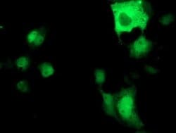 ATP6V1B1 Monoclonal Antibody (OTI6D2), TrueMAB , OriGene 100 &mu;L; Unconjugated:Antibodies,