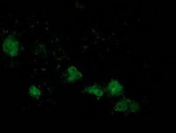 ATP6V1B1 Monoclonal Antibody (OTI2D2), TrueMAB , OriGene 100 &mu;L; Unconjugated:Antibodies,