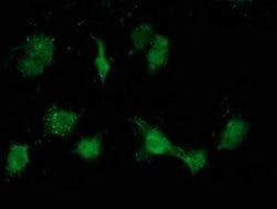 ATP6V1B1 Mouse anti-Human, Clone: OTI1H6, lyophilized, TrueMAB 100 &mu;g;