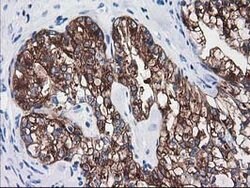 ATP6V1B1 Mouse anti-Human, Clone: OTI3B11, lyophilized, TrueMAB 100 &mu;g;