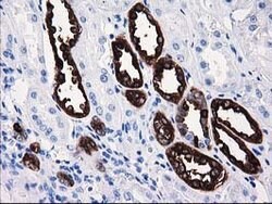 ATP6V1B1 Mouse anti-Human, Clone: OTI3B11, lyophilized, TrueMAB 100 &mu;g;