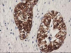 ATP6V1B1 Mouse anti-Human, Clone: OTI1H6, lyophilized, TrueMAB 100 &mu;g;
