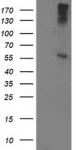 ATP6V1B1 Mouse anti-Human, Clone: OTI6D2, lyophilized, TrueMAB 100 &mu;g;