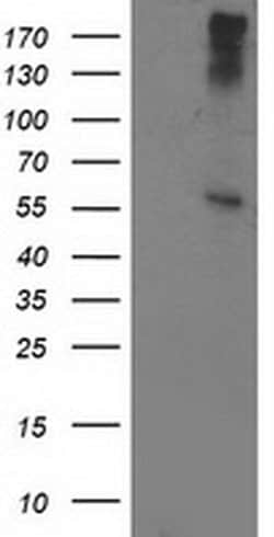 ATP6V1B1 Monoclonal Antibody (OTI6D2), TrueMAB , OriGene 100 &mu;L; Unconjugated:Antibodies,