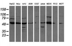 ATP6V1B1 Monoclonal Antibody (OTI6D2), TrueMAB , OriGene 100 &mu;L; Unconjugated:Antibodies,