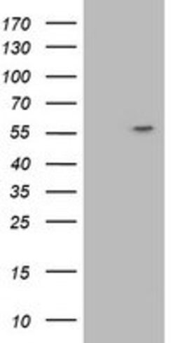 ATP6V1B1 Mouse anti-Human, Clone: OTI3B11, lyophilized, TrueMAB 100 &mu;g;