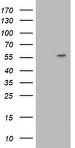 ATP6V1B1 Monoclonal Antibody (OTI3B11), TrueMAB , OriGene 30 &mu;L; Unconjugated:Antibodies,