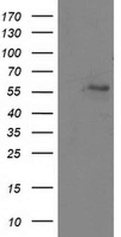 ATP6V1B1 Monoclonal Antibody (OTI2D2), TrueMAB , OriGene:Antibodies:Primary