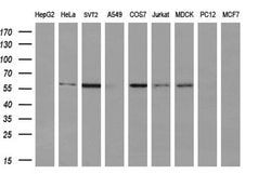 ATP6V1B1 Monoclonal Antibody (OTI2D2), TrueMAB , OriGene 100 &mu;L; Unconjugated:Antibodies,
