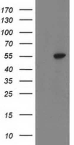 ATP6V1B1 Mouse anti-Human, Clone: OTI1H6, lyophilized, TrueMAB 100 &mu;g;