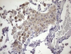 ATP6V1C2 Mouse anti-Human, Clone: OTI3E9, lyophilized, TrueMAB 100 &mu;g;