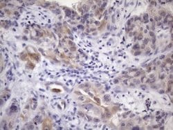 ATP6V1C2 Mouse anti-Human, Clone: OTI3E9, lyophilized, TrueMAB 100 &mu;g;
