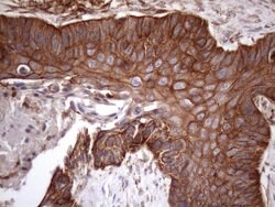 ATP6V1C2 Monoclonal Antibody (OTI8H4), TrueMAB , OriGene 100 &mu;L; Unconjugated:Antibodies,