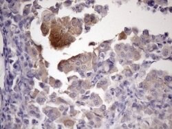 ATP6V1C2 Monoclonal Antibody (OTI8H4), TrueMAB , OriGene 100 &mu;L; Unconjugated:Antibodies,