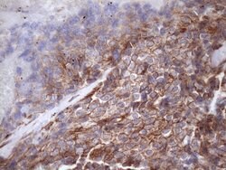 ATP6V1C2 Monoclonal Antibody (OTI8H4), TrueMAB , OriGene 100 &mu;L; Unconjugated:Antibodies,