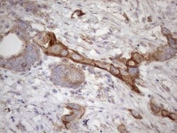 ATP6V1C2 Monoclonal Antibody (OTI8H4), TrueMAB , OriGene 100 &mu;L; Unconjugated:Antibodies,