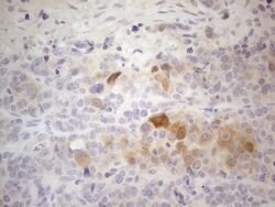 ATP6V1C2 Mouse anti-Human, Clone: OTI2H3, lyophilized, TrueMAB 100 &mu;g;