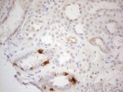 ATP6V1C2 Mouse anti-Human, Clone: OTI2H3, lyophilized, TrueMAB 100 &mu;g;