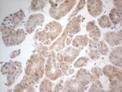 ATP6V1C2 Mouse anti-Human, Clone: OTI2H3, lyophilized, TrueMAB 100 &mu;g;